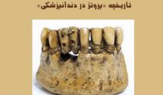 رادیوصبا با روایتی طنز از تاریخچه «پروتز در دندانپزشکی»