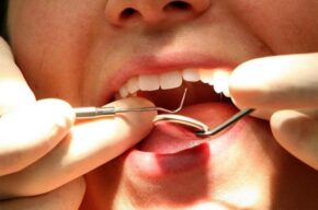 نگاهی طنز به اهمیت سلامتی دهان و دندان در رادیو صبا