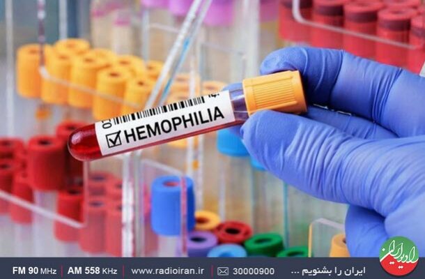 بررسی کمبود داروهای هموفیلی در «ایران امروز» رادیو ایران بررسی کمبود داروهای هموفیلی در «ایران امروز» رادیو ایران